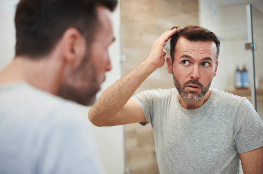 A man thinking about hair loss solutions