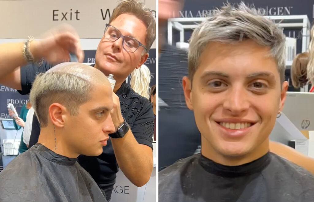 Young man receiving Non-Invasive Hair Loss Solution